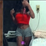 15637723