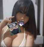 20447726